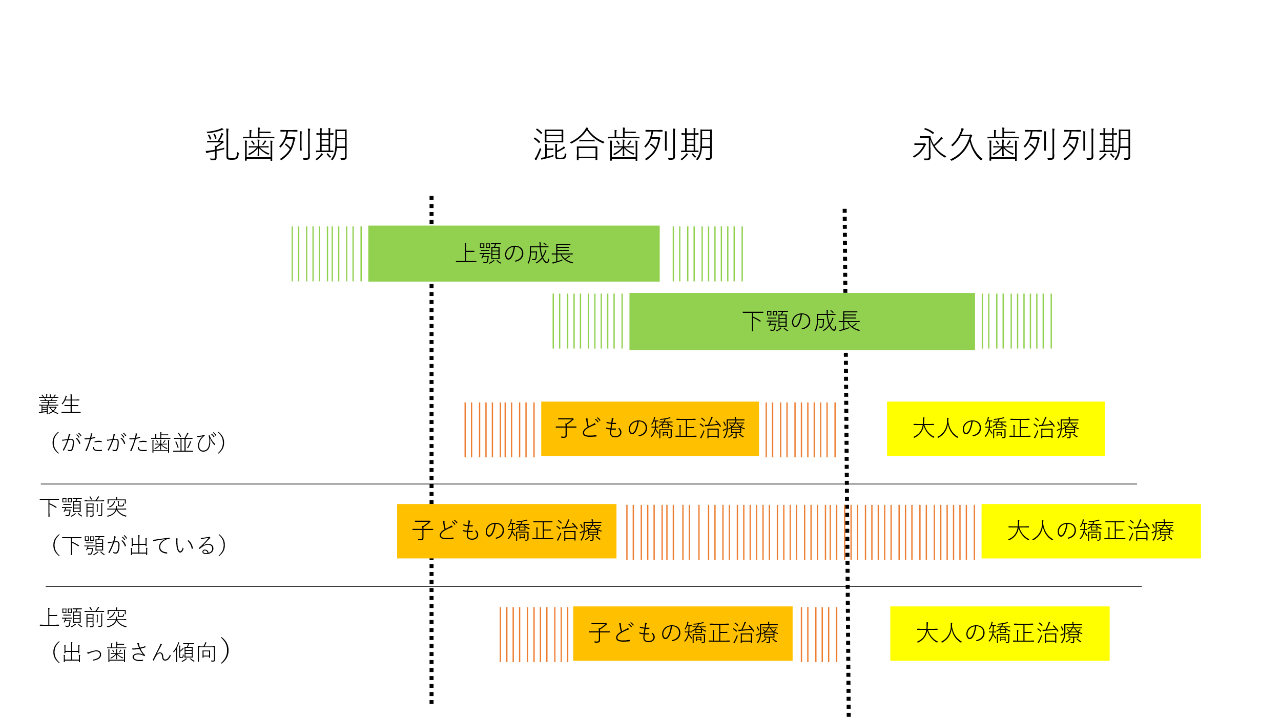 混合歯列期の矯正治療 - 本